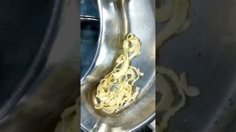 Tapeworm (cestodes) Surgical Removal In A Patient | Informative Video ...