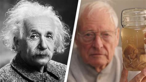 Thomas Stolz Harvey: Twisted tale of man who stole Albert Einstein's brain - News - UNILAD