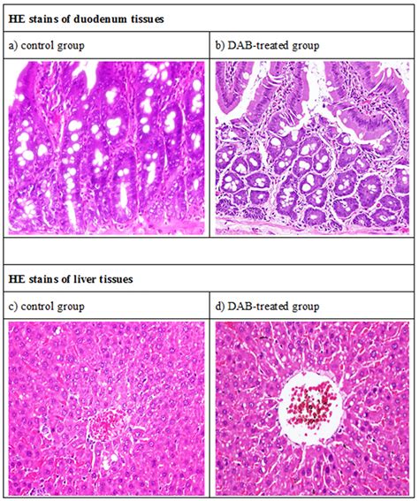 What Is Hematoxylin And Eosin Staining Used For - Peter Brown Bruidstaart