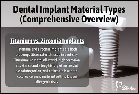 Dental Implant Material Types (Comprehensive Overview) | MDA