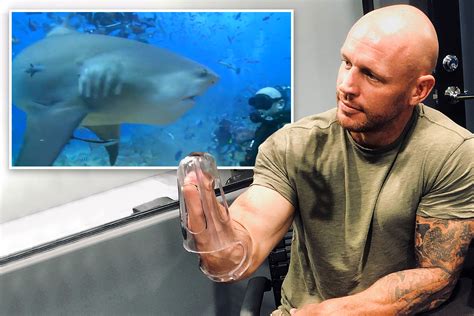 Shark attack survivor who had hand and leg ripped off by beast describes attacks as ‘a bad day ...