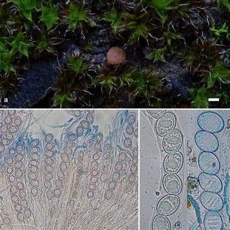 Ascocarp (a), asci and paraphyses (b) and ascospores (c) of Octospora... | Download Scientific ...