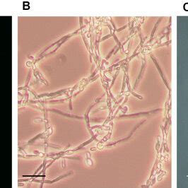 Candida krusei cell and colony morphology. (A) Yeast cells were grown ...