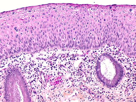 Histopathology and cytopathology of the uterine cervix - digital atlas ...