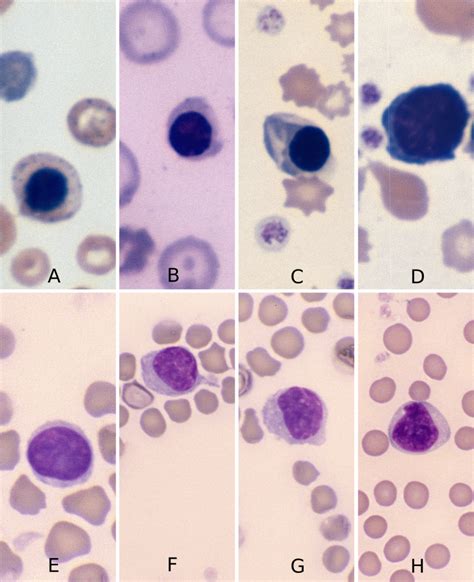 Nucleated Red Blood Cells – Cells and Smears