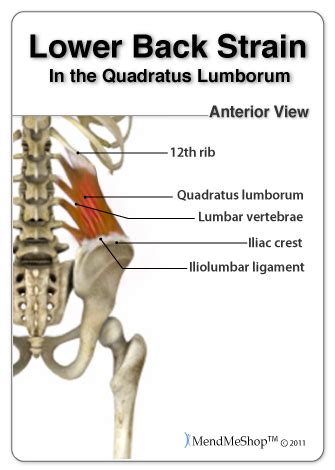 Lower Back Strain & Pain