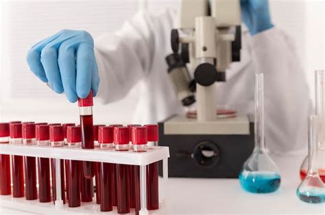 RDW Blood Test Understanding High RDW Symptoms