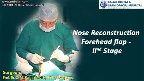 Nose Reconstruction Forehead flap - II Stage - YouTube