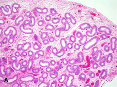 American Urological Association - Epididymis