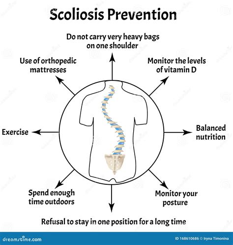 Prevention Of Scoliosis. Spinal Curvature, Kyphosis, Lordosis Of The Neck, Scoliosis, Arthrosis ...