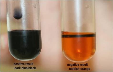 Testing for Biological Molecules - Microbe Notes