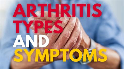 Arthritis Types And Symptoms - Geek Consumers