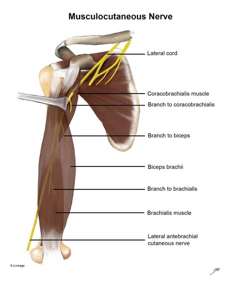 Musculocutaneous Nerve Entrapment Syndrome (근피 신경 포착 증후군) : 네이버 블로그