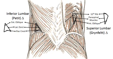 Hernia - The Others | Epomedicine