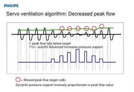 ASV -Adaptive Servo Ventilation | Algorithm, Ventilation, Cpap