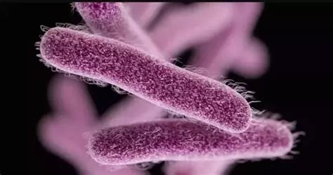 What are the differences between salmonella and shigella? What are the similarities? - Quora