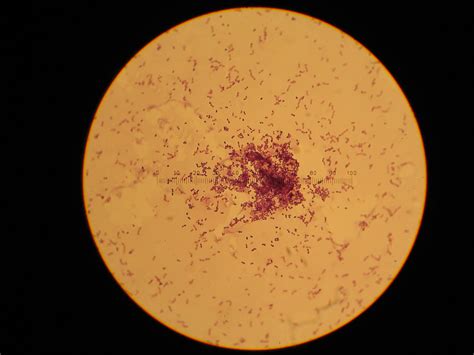 Streptococcus lactis | Gram stained smear, 100X (oil immersi… | Minyoung Choi | Flickr