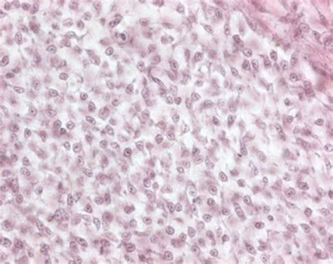 Mesenchymal Connective Tissue