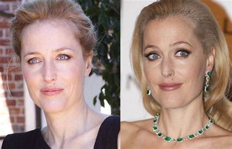 Gillian Anderson Plastic Surgery Rumors and Facts