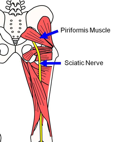 Muscle Tightness: Piriformis Muscle Tightness Pain