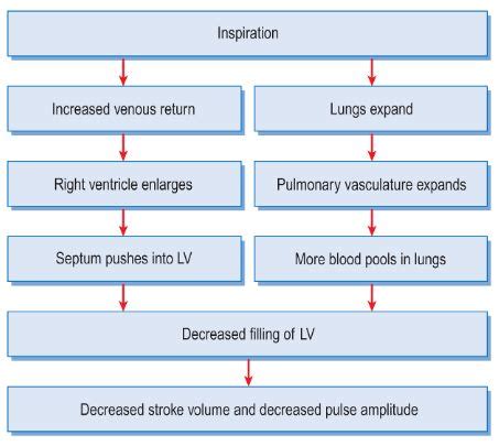 Pulsus Paradoxus - Clinical Examination | Epomedicine