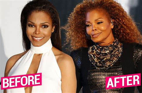 Janet Jackson Unrecognizable After Massive Plastic Surgery Makeover