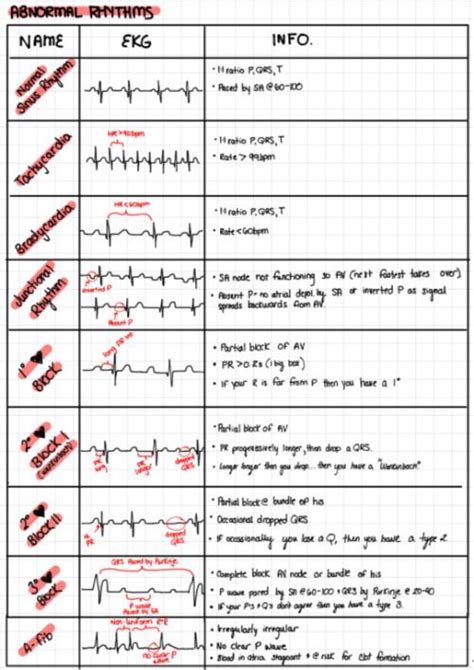 Abnormal Ecg Rhythms | Medical surgical nursing, Nursing school notes ...