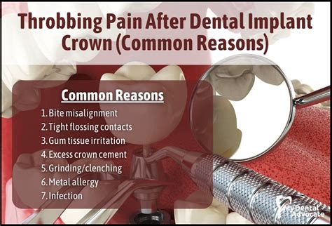 Dental Crown Cement Pain | edu.svet.gob.gt