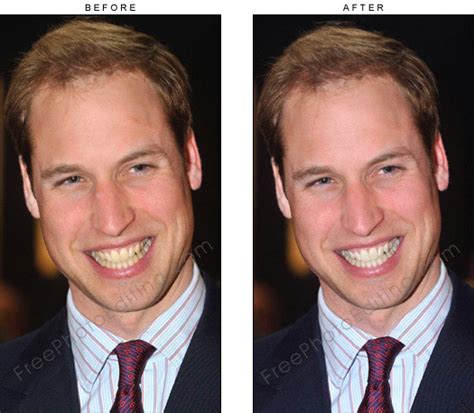 Prince William has his teeth whitened days ahead of the wedding (with ...