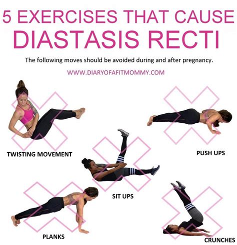 31++ Exercises that help diastasis recti women | perfectabsworkout