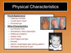 30 Smith-Magenis Syndrome ideas | syndrome, smith, genetic disorders