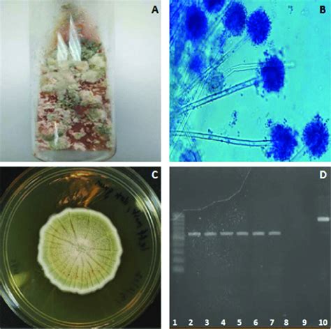 (A) Primary fungal culture. Colonies of different colours were observed... | Download Scientific ...