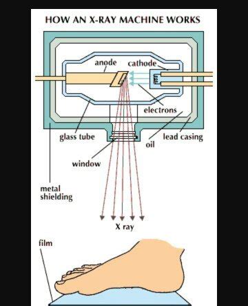 particle accelerators - Difference between X-ray device and linac - Physics Stack Exchange