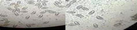 Figure 4 from Enterobius vermicularis infection in relation to appendicitis and fallopian tube ...