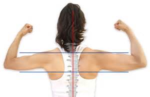 muscle imbalance diagram