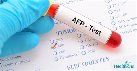 What You Need To Know About Alpha-Fetoprotein (AFP) Test