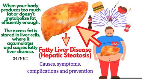 Fatty Liver Disease (Hepatic Steatosis) - What causes hepatic steatosis? | 247nht - YouTube