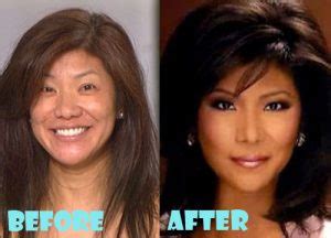 Julie Chen Plastic Surgery Before and After Nose Job - Lovely Surgery