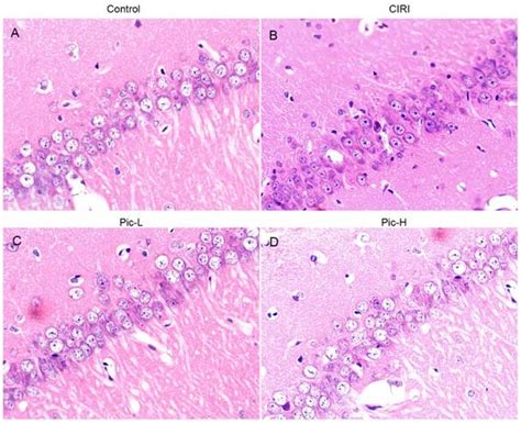 Histological analysis of the effects of Pic on neuronal injury induced... | Download Scientific ...