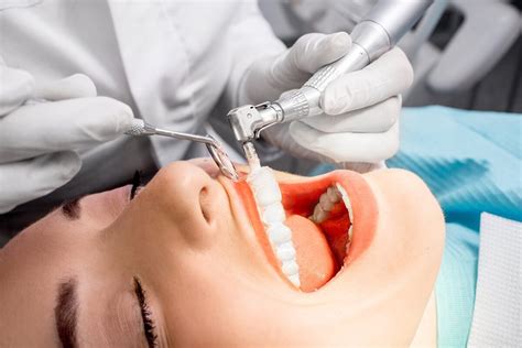 What is a Prophylaxis? | Advanced Dental Care of Anderson