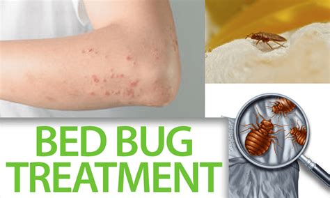 Facts You Need Know About The Bed Bug Treatment | by Hello PestControl | Medium