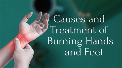 Burning hands and feet — Causes and treatment of burning hands and feet ...