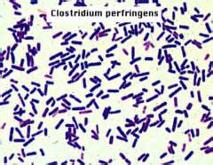 604 - Basic & Laboratory Sciences - Microbiology I Flashcards | Quizlet