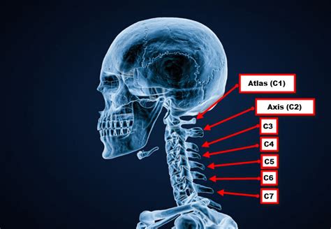 How To Tell If You Have A Broken Neck - JOI & JOI Rehab