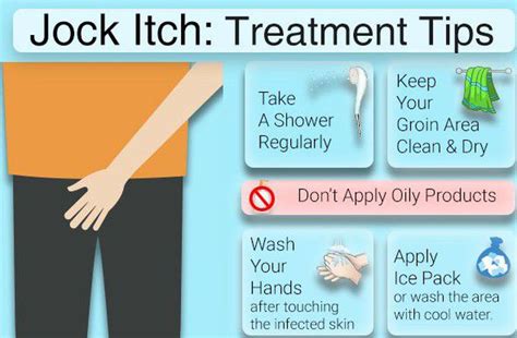 Treatment for jock itch - MEDizzy