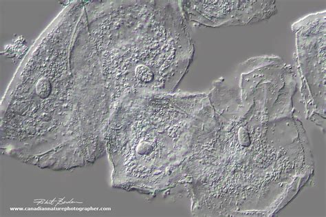 Differential Interference Contrast Microscopy (DIC) - The Canadian Nature Photographer - Robert ...