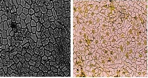 a. Palisade cells arrangement under epidermal cells; b. veins ...