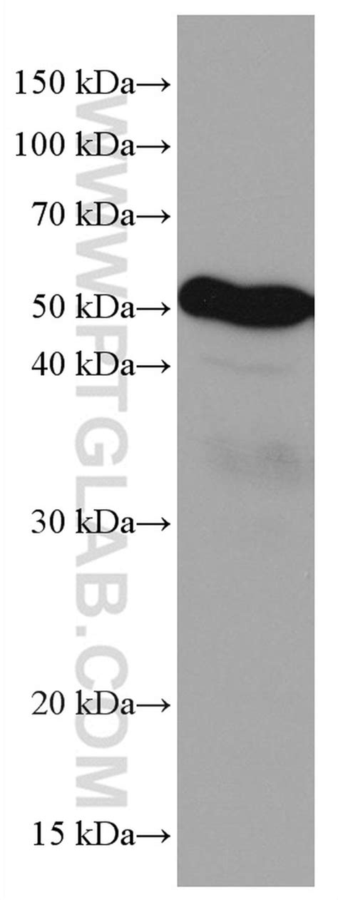 LILRB4 Monoclonal Antibody (1C8E1) (67119-1-IG)