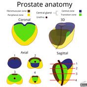 Prostate | Radiology Reference Article | Radiopaedia.org