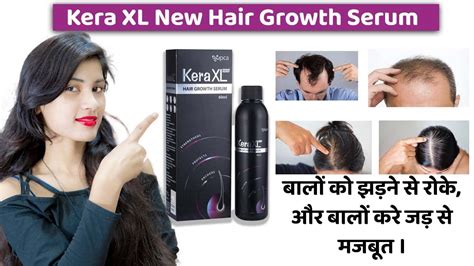 Kera XL New Hair Growth Serum | hair fall | Side Effects | Review in Hindi - YouTube